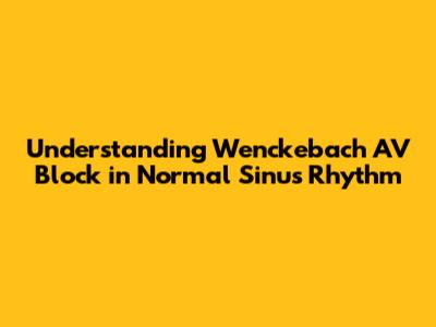 Understanding Wenckebach AV Block in Normal Sinus Rhythm